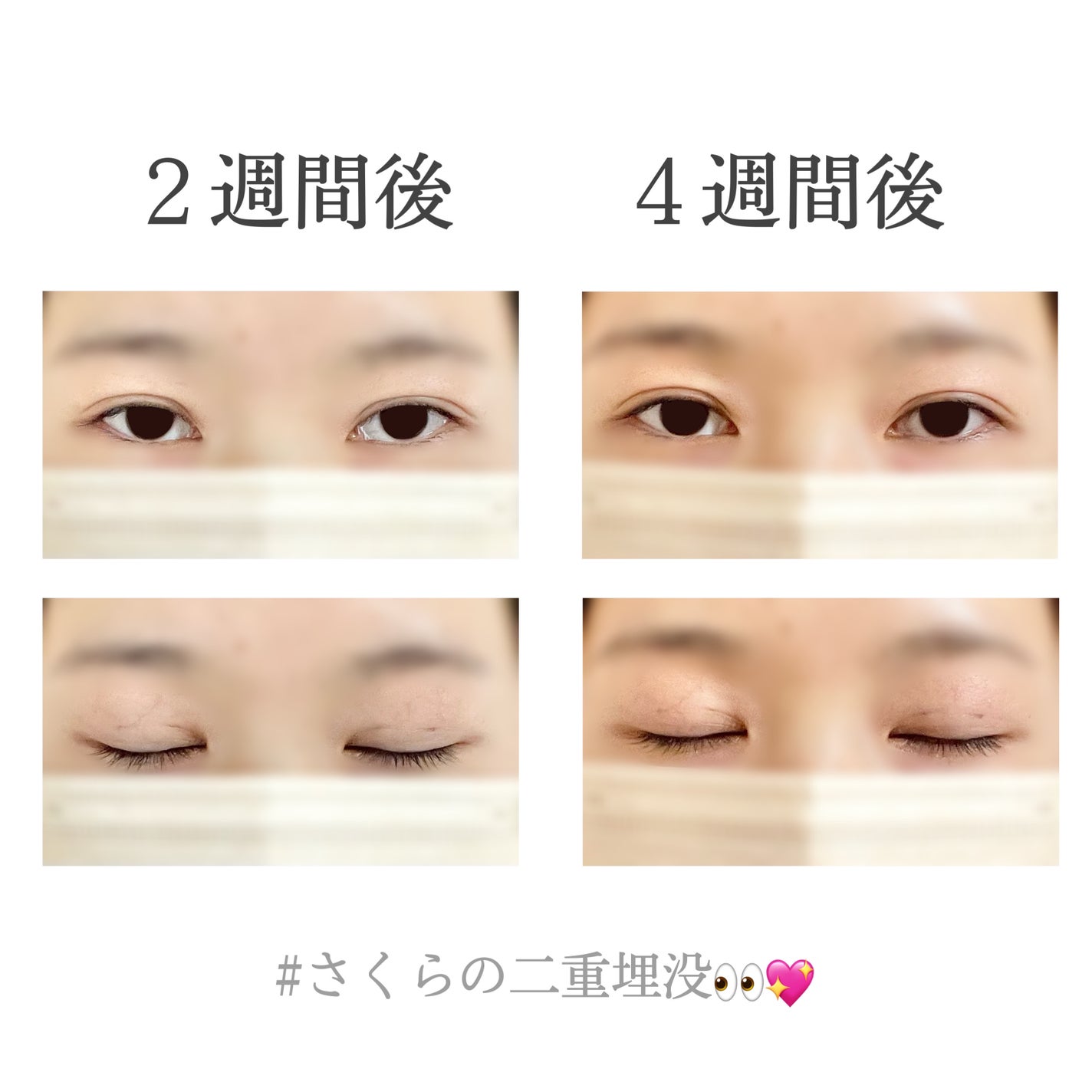 ãããðž on LIPS ãè²»çšãïŒäºéåæ²¡äœéšèšâ£ðð(æœè¡ïŒé±éåŸãçŸåš)------..ãïŒ2æç®ïŒ