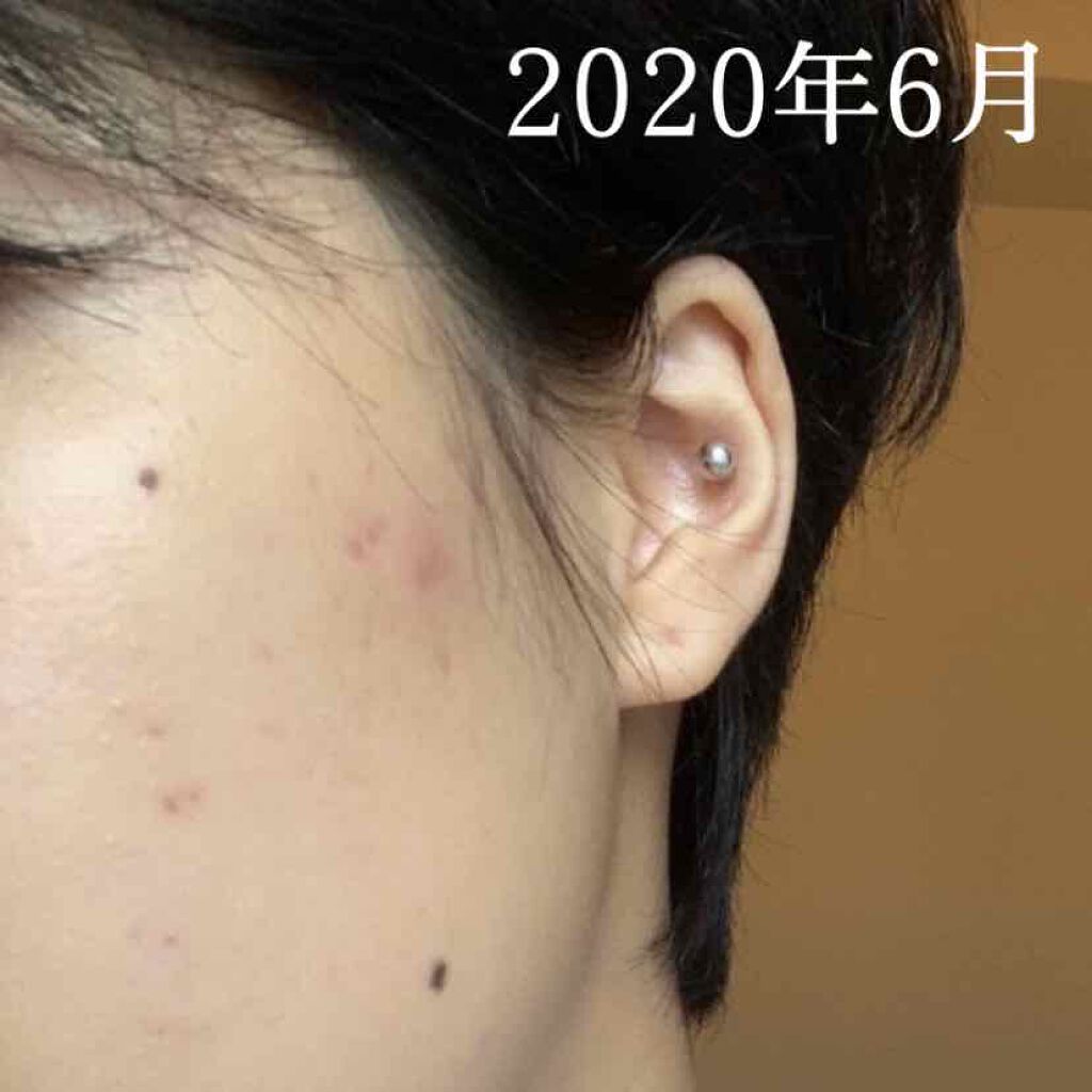 オルビスユー ウォッシュ/オルビス/洗顔フォームを使ったクチコミ(1枚目)