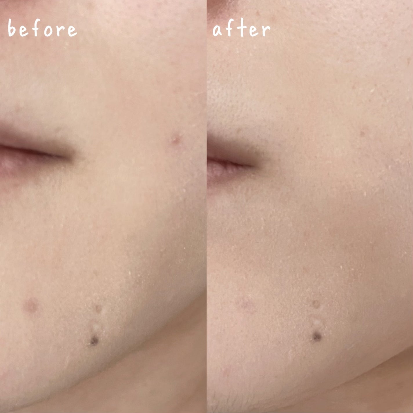 イプノス シーバムクリア リペアクリーム/ACSEINE/フェイスクリームを使ったクチコミ(2枚目)