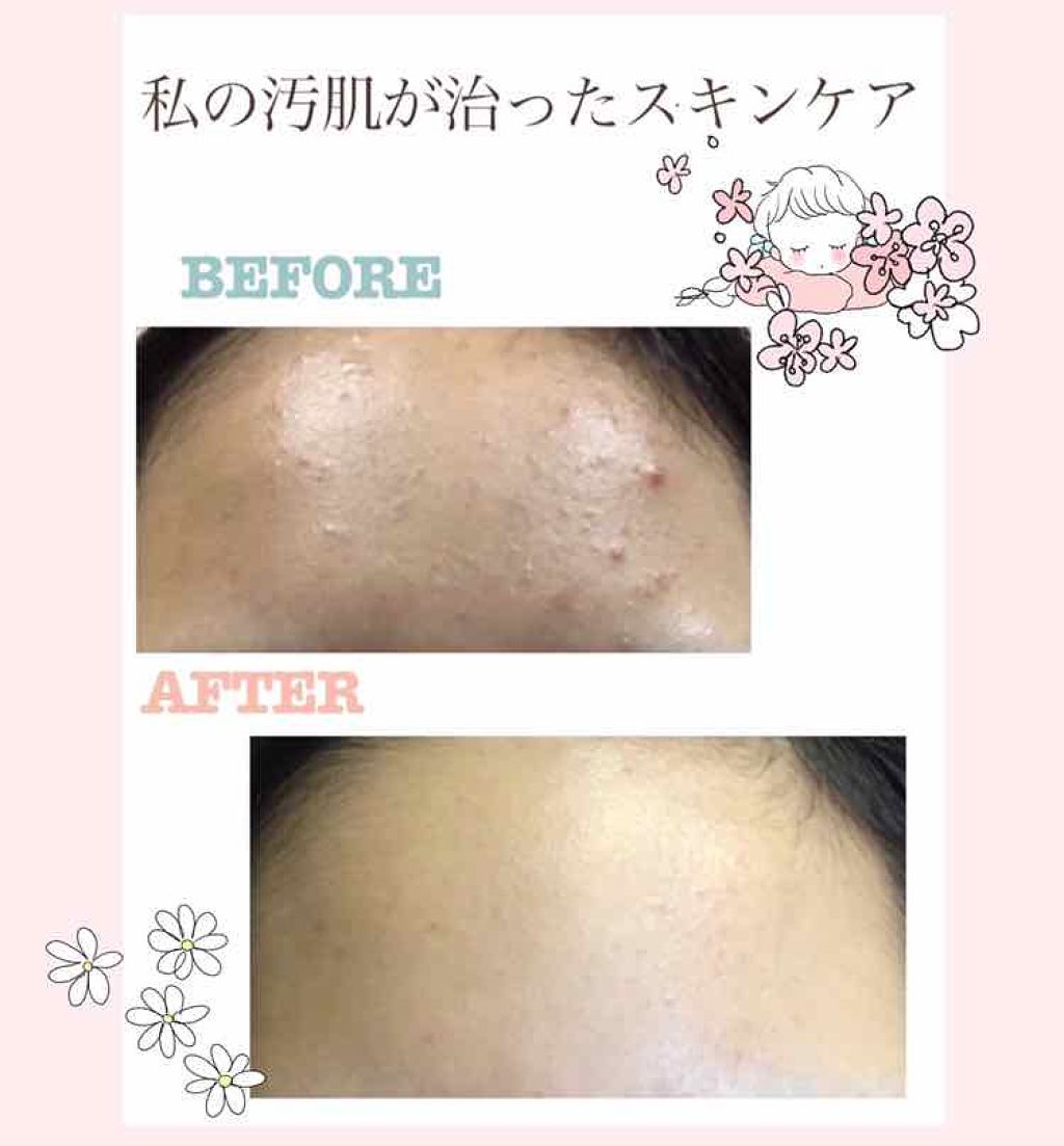 ハトムギ化粧水(ナチュリエ スキンコンディショナー R )/ナチュリエ/化粧水を使ったクチコミ(1枚目)