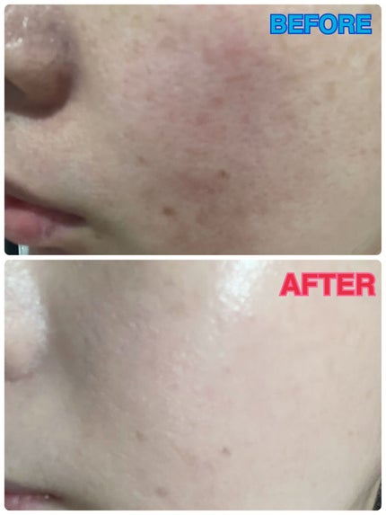 シカマヌ セラム クッションファンデ/parnell/クッションファンデーションを使ったクチコミ(4枚目)