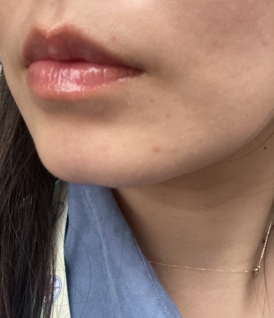 ガラスプランパー 102 ヴァンパイアレッド/CipiCipi/リッププランパーを使ったクチコミ（2枚目）