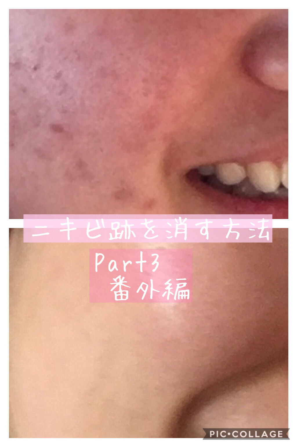 マイルド＆モイスチャーアロエジェル/ネイチャーリパブリック/ボディローションを使ったクチコミ（1枚目）