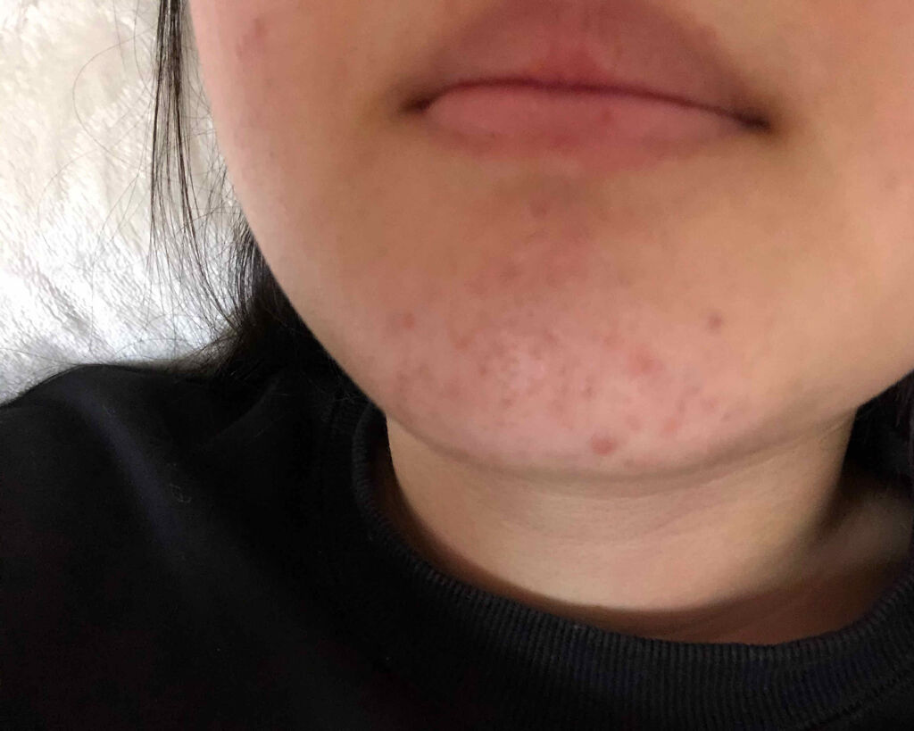 化粧水・敏感肌用・高保湿タイプ/無印良品/化粧水を使ったクチコミ（2枚目）