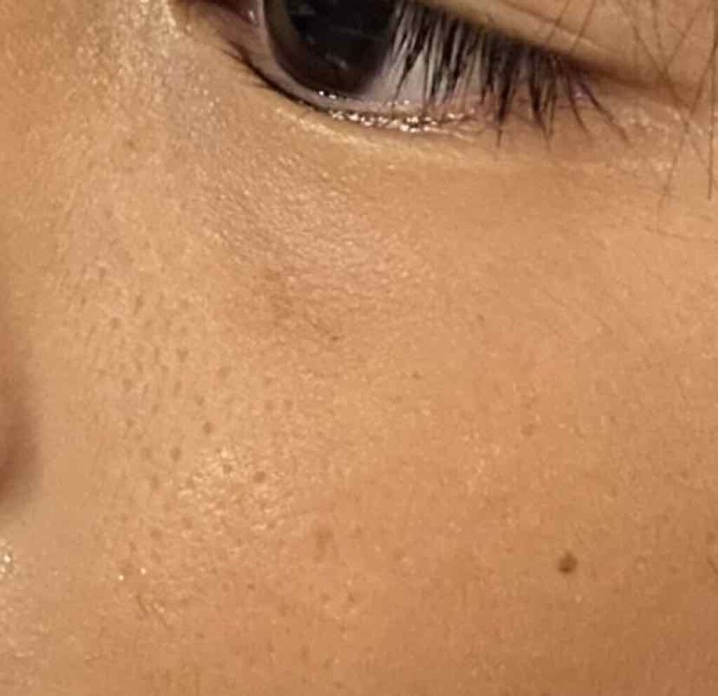 S on LIPS 「初投稿ですみません🙏弟の肌のぶつぶつが気になります😭何を使って..」(2枚目)