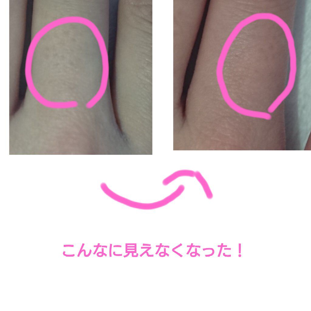 プレミア敏感肌用 Lディスポ/シック/シェーバーを使ったクチコミ（3枚目）