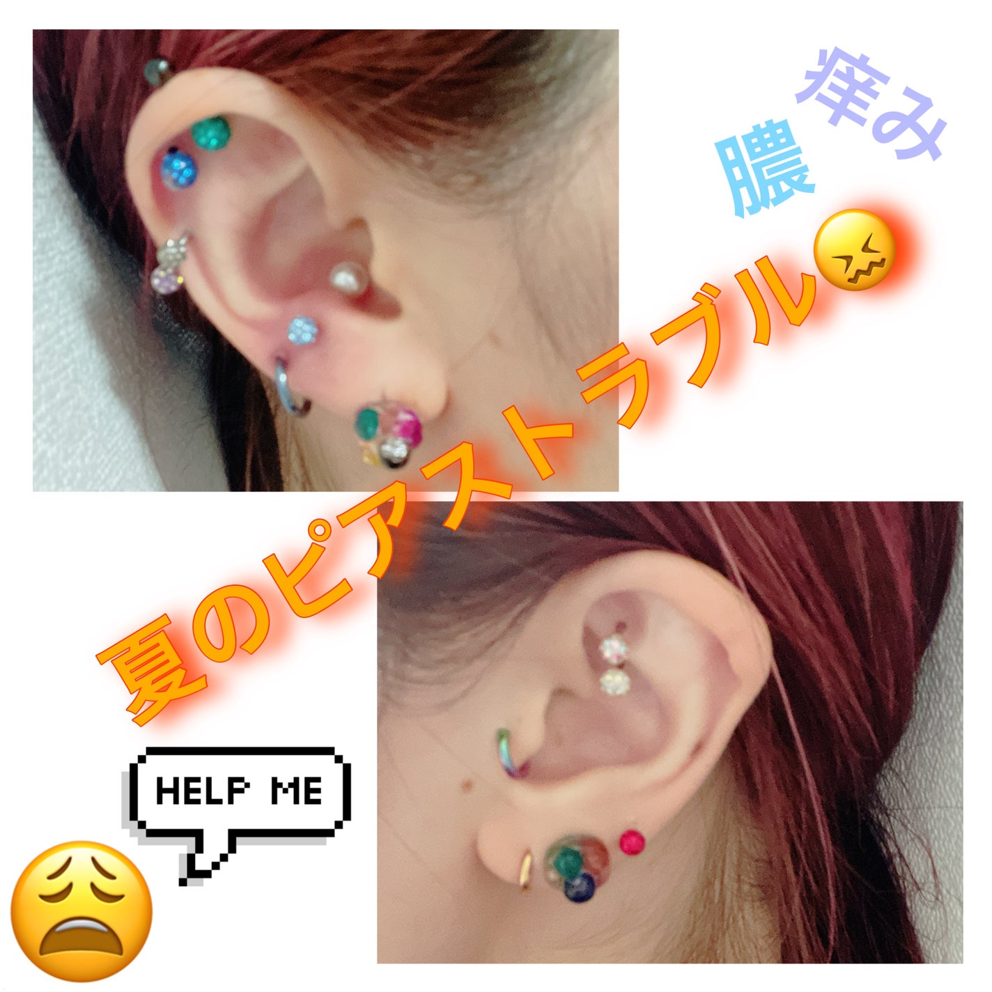 オロナインH軟膏 (医薬品)/オロナイン/その他を使ったクチコミ(1枚目)