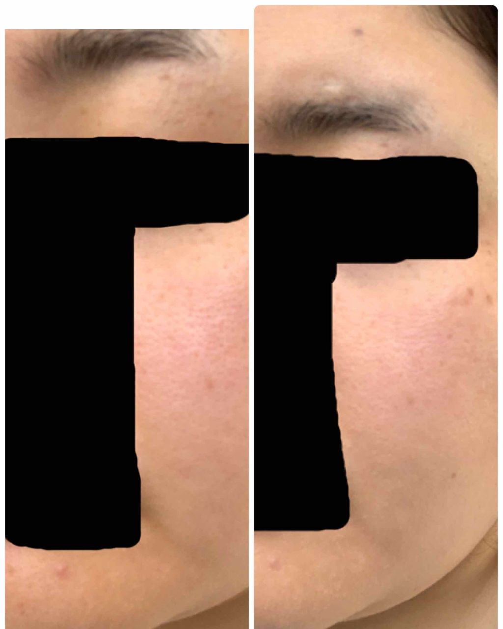 BBミネラルホワイト/ettusais/BBクリームを使ったクチコミ（3枚目）