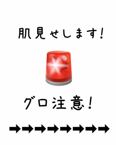 トラブルリペア リキッド/アルージェ/美容液を使ったクチコミ（2枚目）