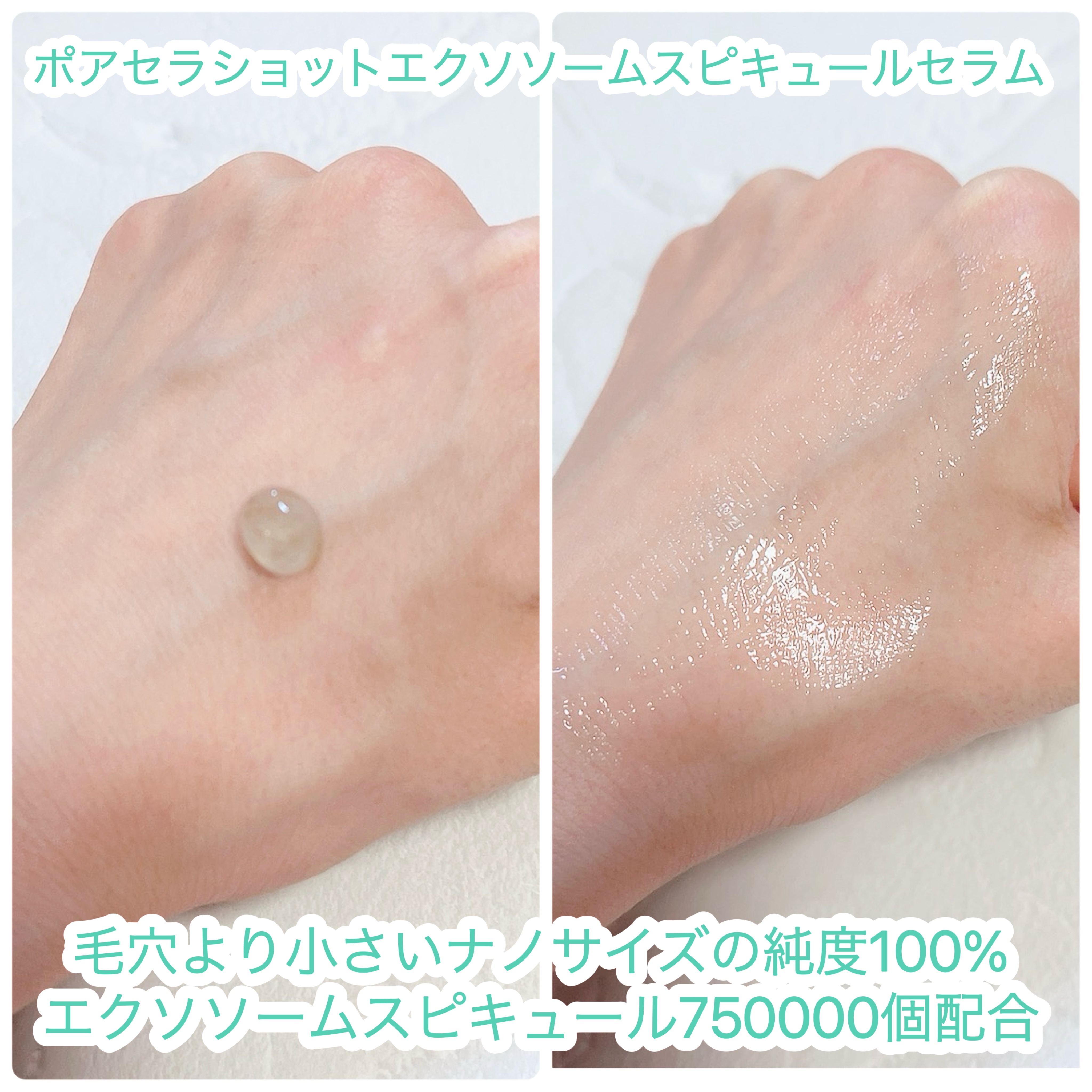 ポアセラショットエクソソームスピキュールセラム＆ ミニマイザー美顔/MEDITHERAPY/美容液を使ったクチコミ（2枚目）