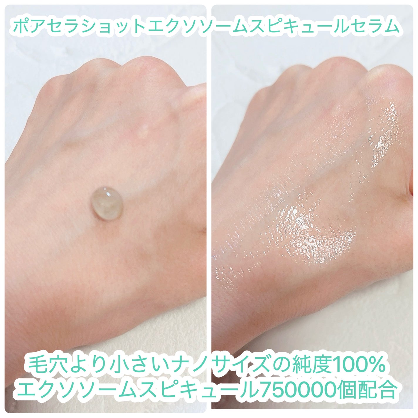 ポアセラショットエクソソームスピキュールセラム& ミニマイザー美顔/MEDITHERAPY/美容液を使ったクチコミ(2枚目)