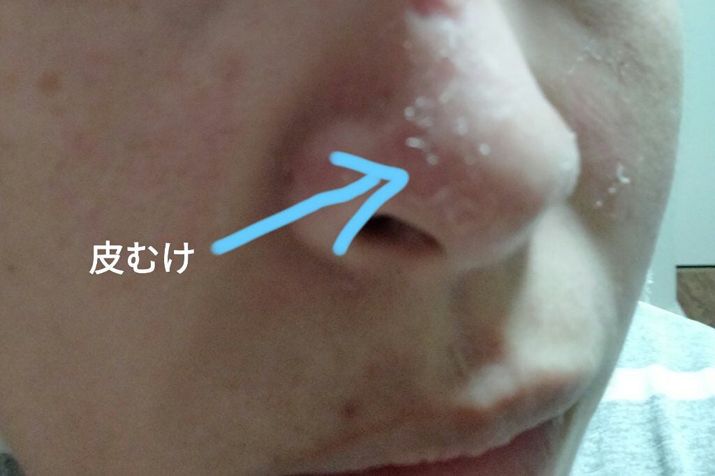 PLACENTREX EXTRACT GEL(ヒトプラセンタジェル)/Placentrex/その他を使ったクチコミ(2枚目)