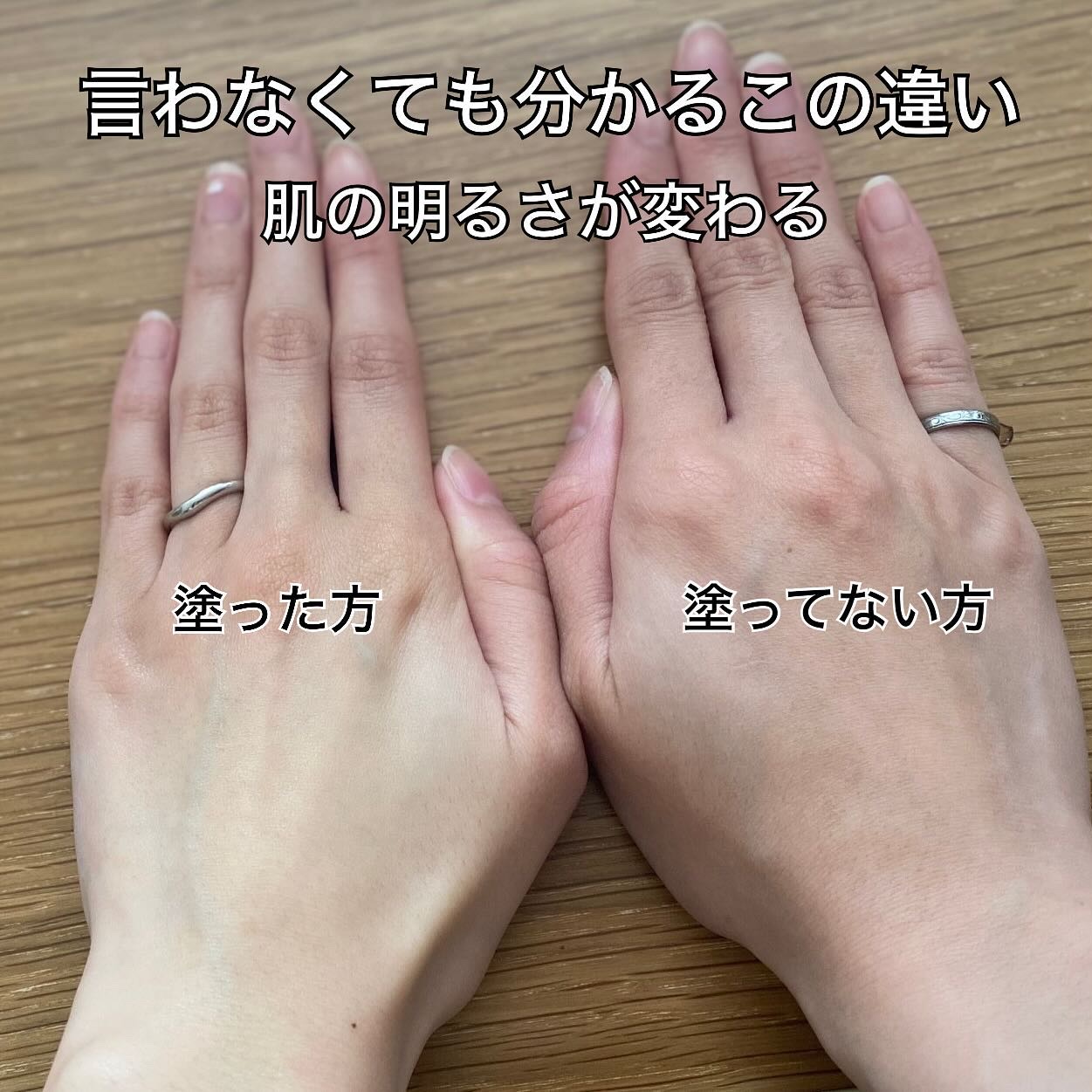 fractionalCC ニードルセラムC/fractionalCC/美容液を使ったクチコミ（3枚目）