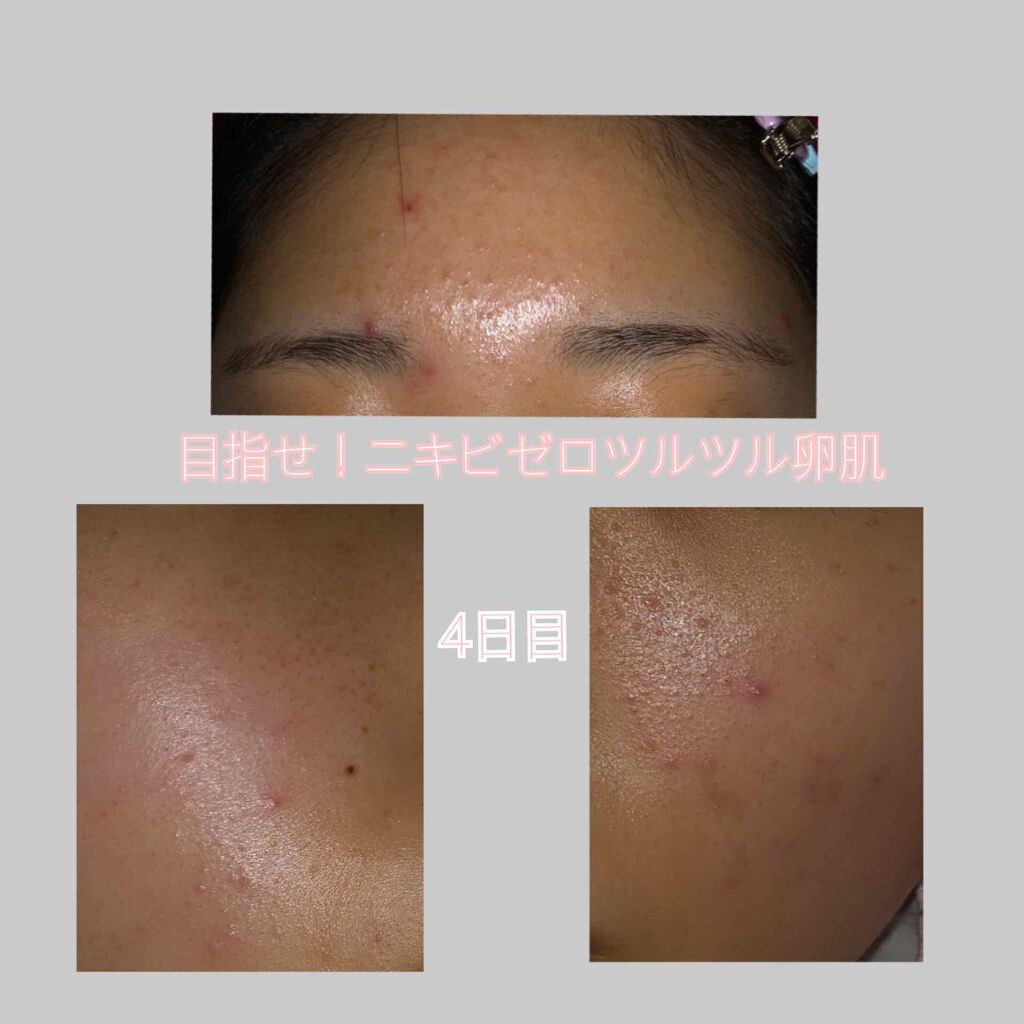 導入化粧液/無印良品/ブースター・導入液を使ったクチコミ（1枚目）