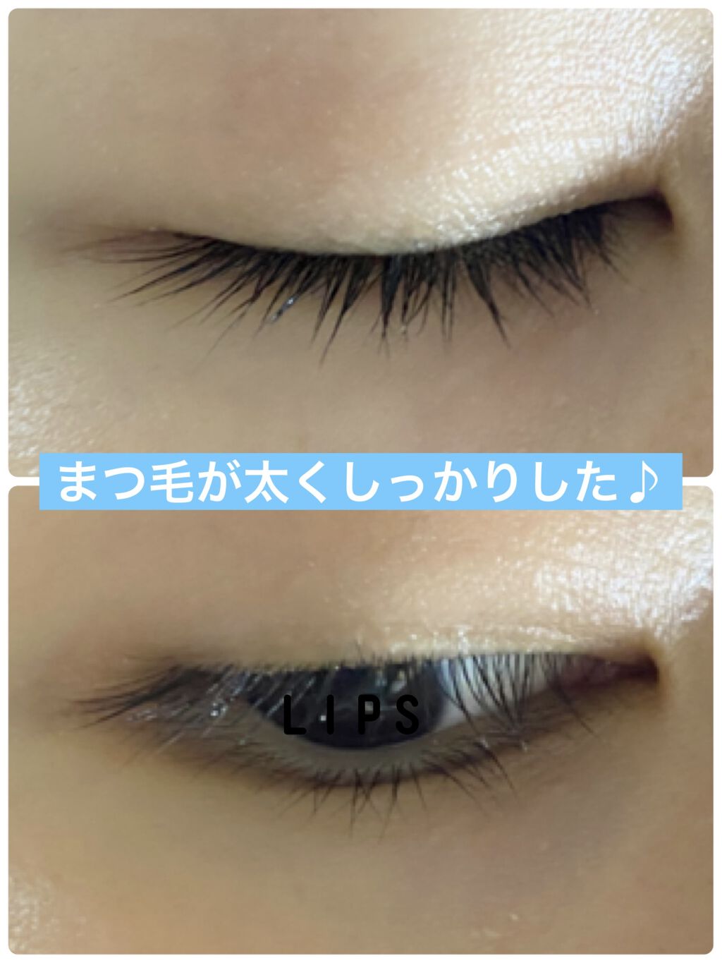 アデノバイタル アイラッシュセラム/資生堂プロフェッショナル/まつげ美容液を使ったクチコミ（3枚目）