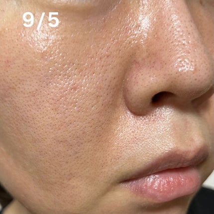 Cサスペンション23+HAスフィア2フェイスクリーム/The Ordinary/美容液を使ったクチコミ(4枚目)