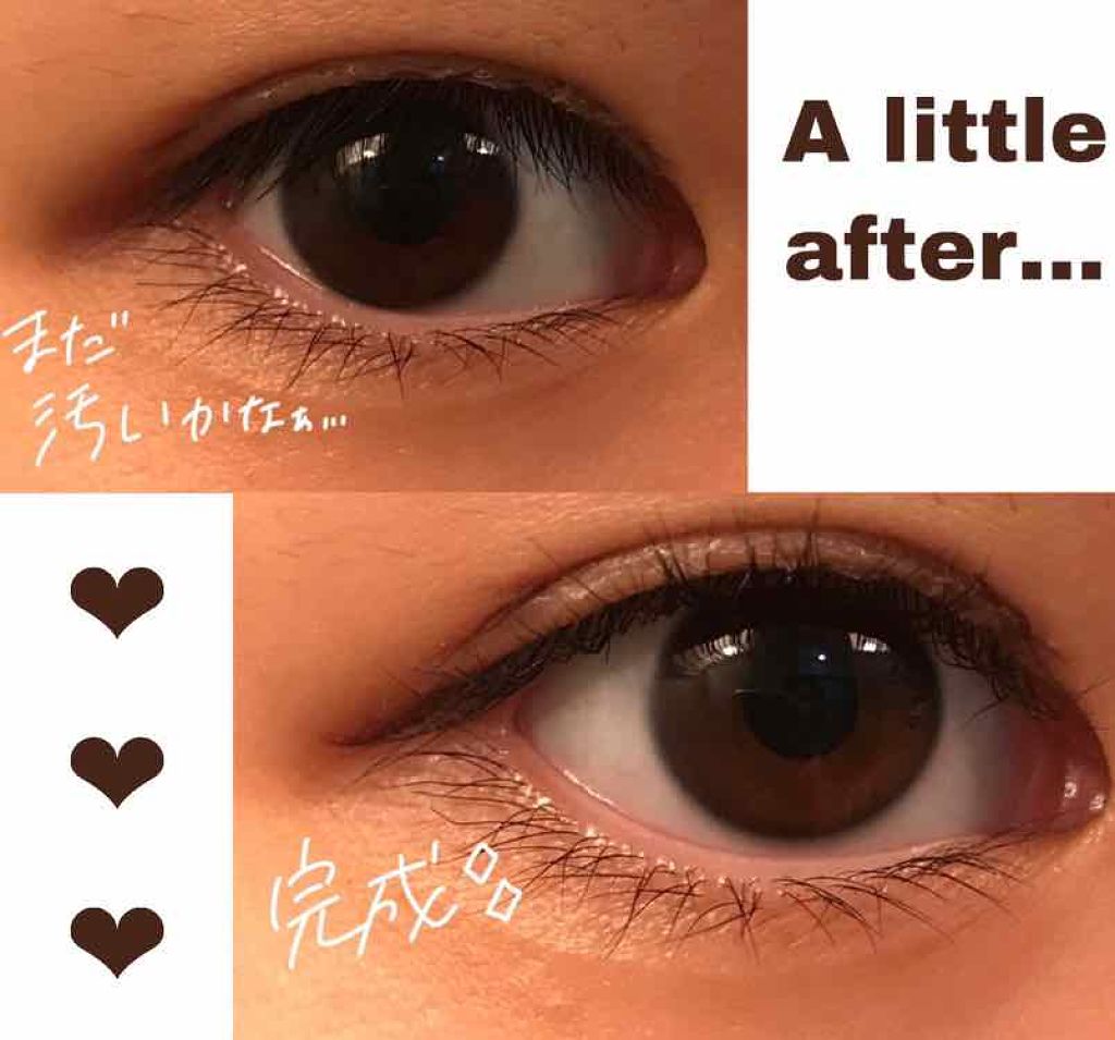 アイビューティー フィクサー WP/アストレア ヴィルゴ/二重まぶた用アイテムを使ったクチコミ(3枚目)
