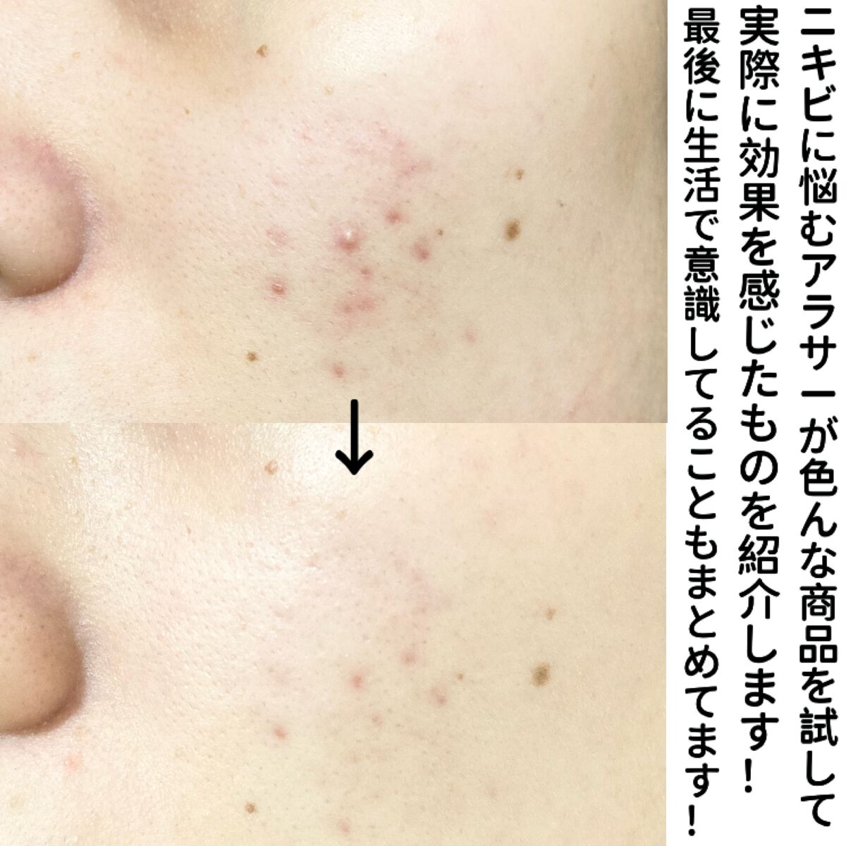 マジックティーツリーオイル/ブラン/フェイスオイルを使ったクチコミ（2枚目）