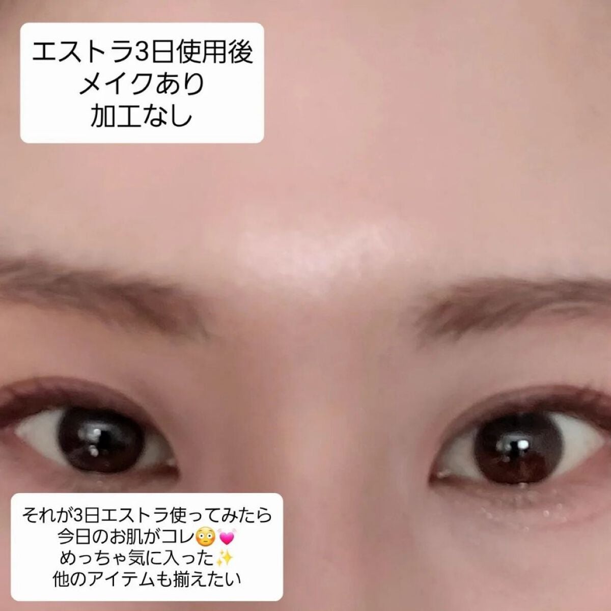 エイシカ365クイックマスクパッド/AESTURA/トナーパッドを使ったクチコミ(3枚目)