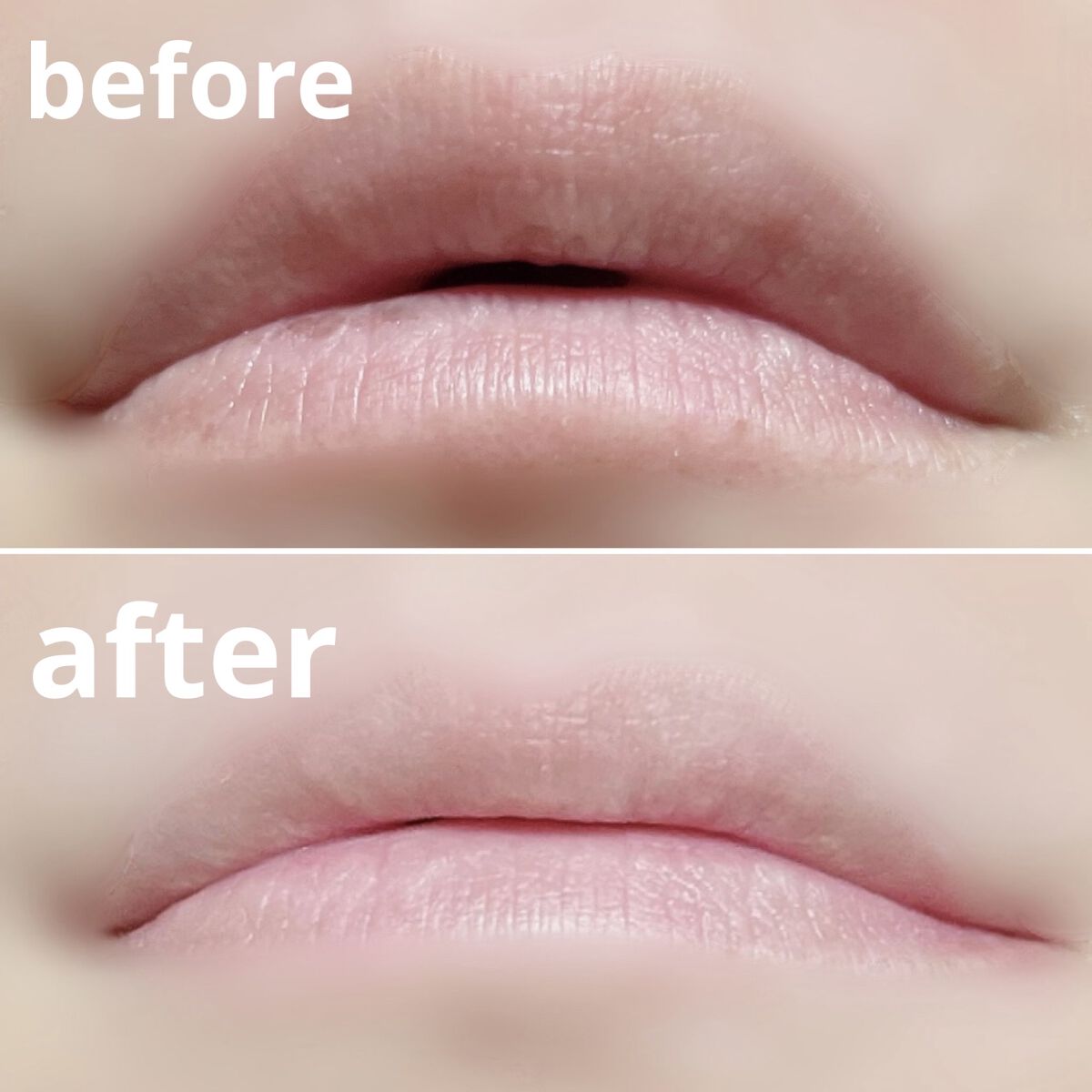 リップエイド集中マスク(プランパー) /トレンドホリック/リップマスクを使ったクチコミ（3枚目）