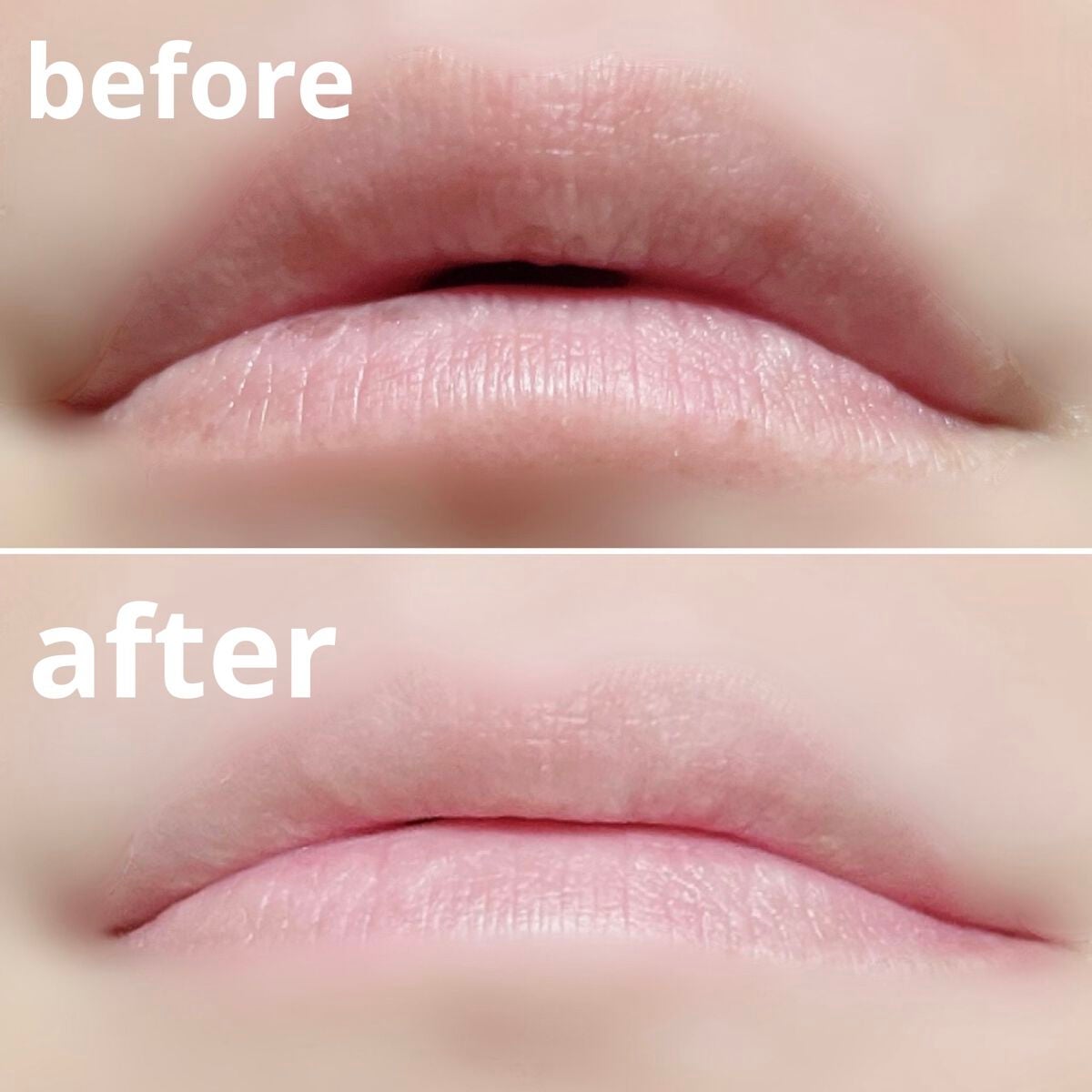 リップエイド集中マスク(プランパー) /トレンドホリック/リップマスクを使ったクチコミ(3枚目)