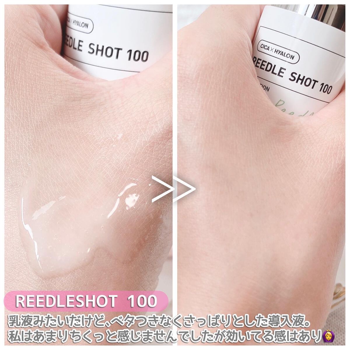 リードルショット100/VT/美容液を使ったクチコミ(4枚目)