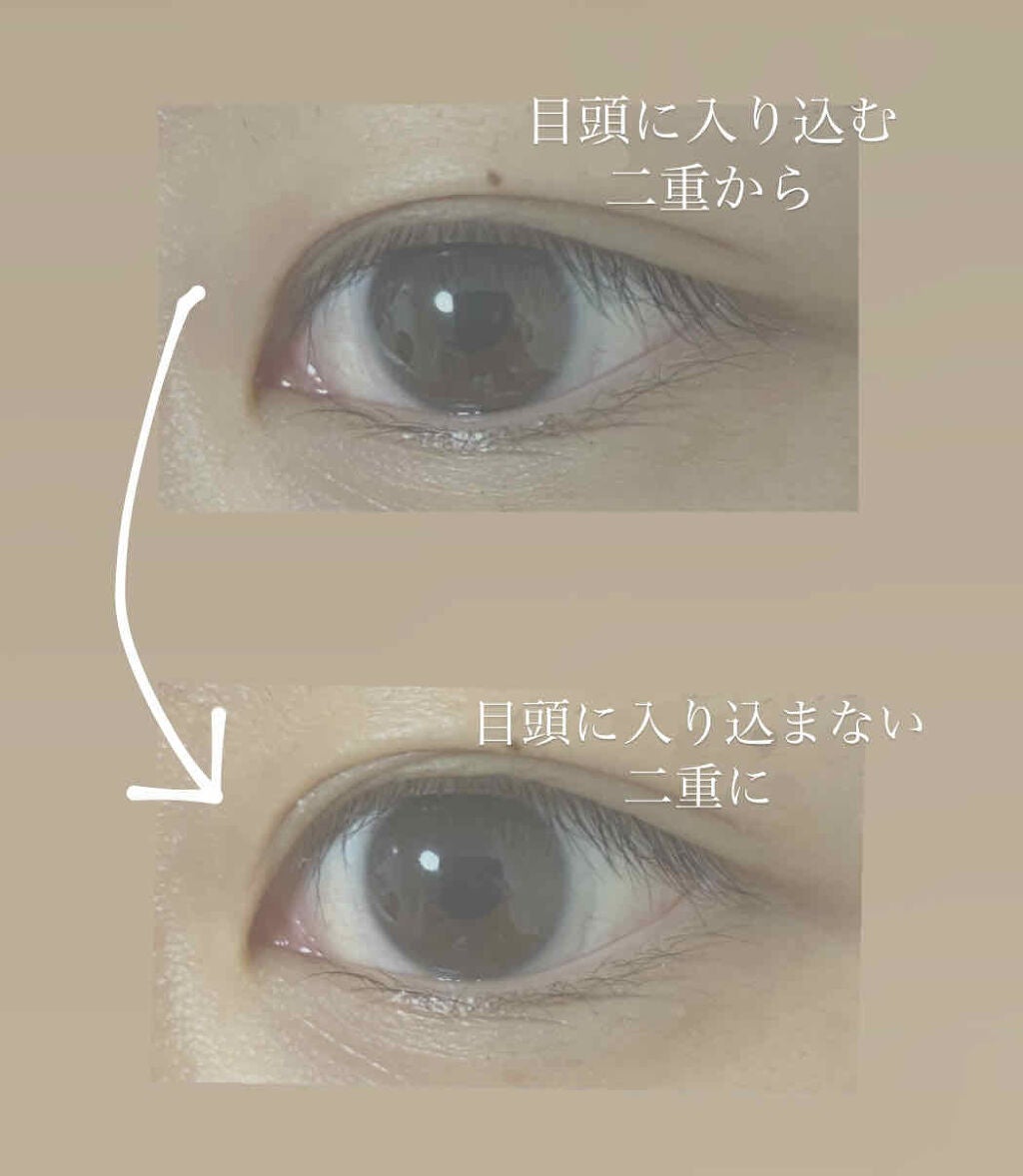 オリシキ アイリッドスキンフィルム /D-UP/二重まぶた用アイテムを使ったクチコミ(2枚目)