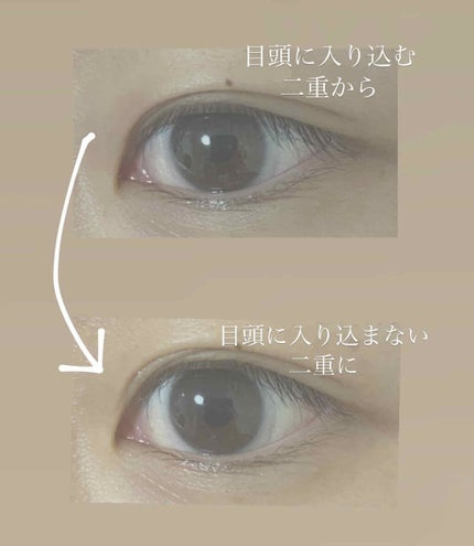 オリシキ アイリッドスキンフィルム /D-UP/二重まぶた用アイテムを使ったクチコミ(2枚目)