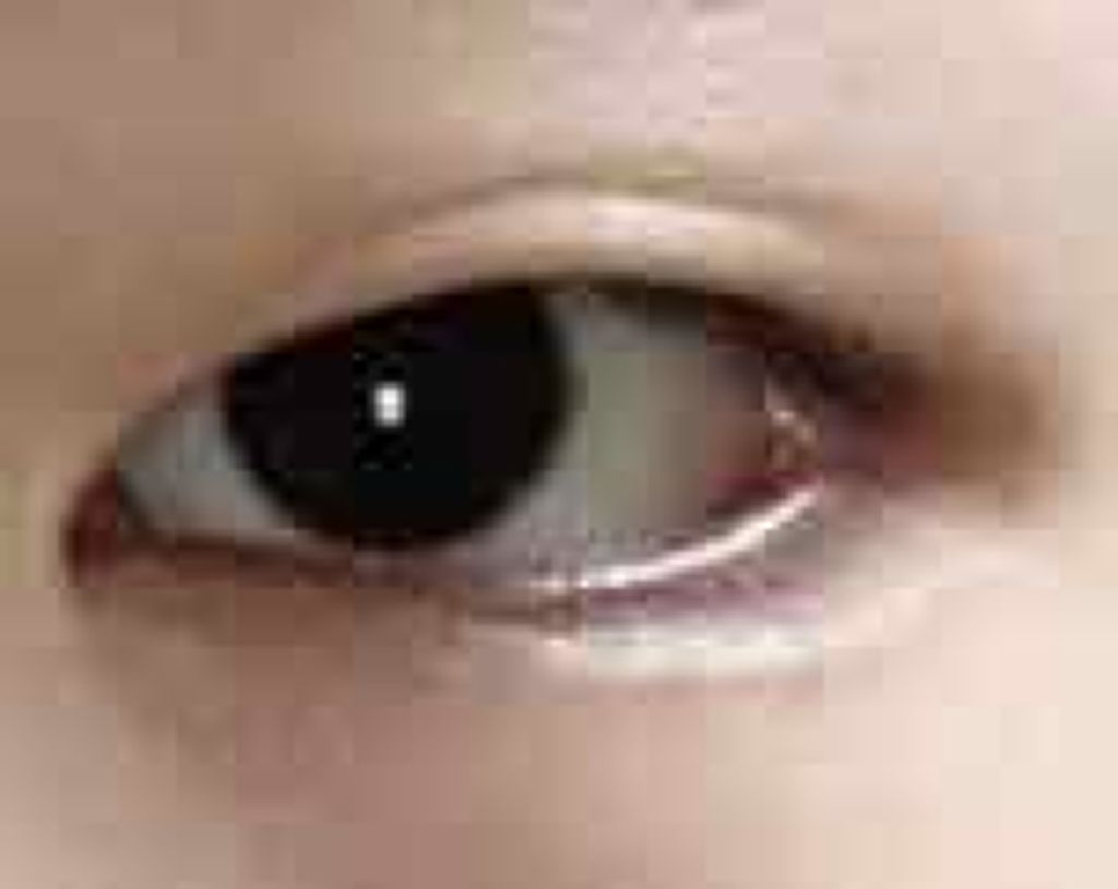 アイテープ片面(のびる)絆創膏タイプ スリム 120枚/セリア/二重まぶた用アイテムを使ったクチコミ(2枚目)