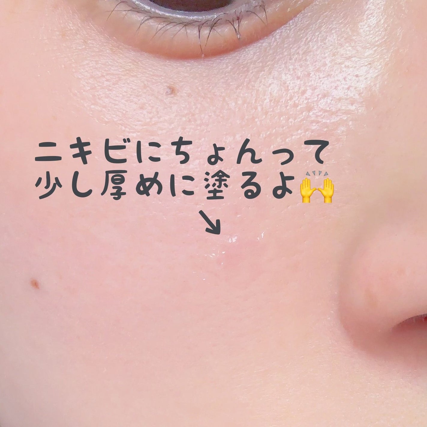 シカスポットクリーム/NATURAL DERMA PROJECT/フェイスクリームを使ったクチコミ(4枚目)