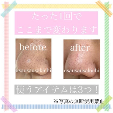 ウサ吉🐰🎀正直レビュー！ on LIPS 「【毛穴汚れに悩んでいる方へ】⚠️毎日の使用は控えてください。お..」（1枚目）