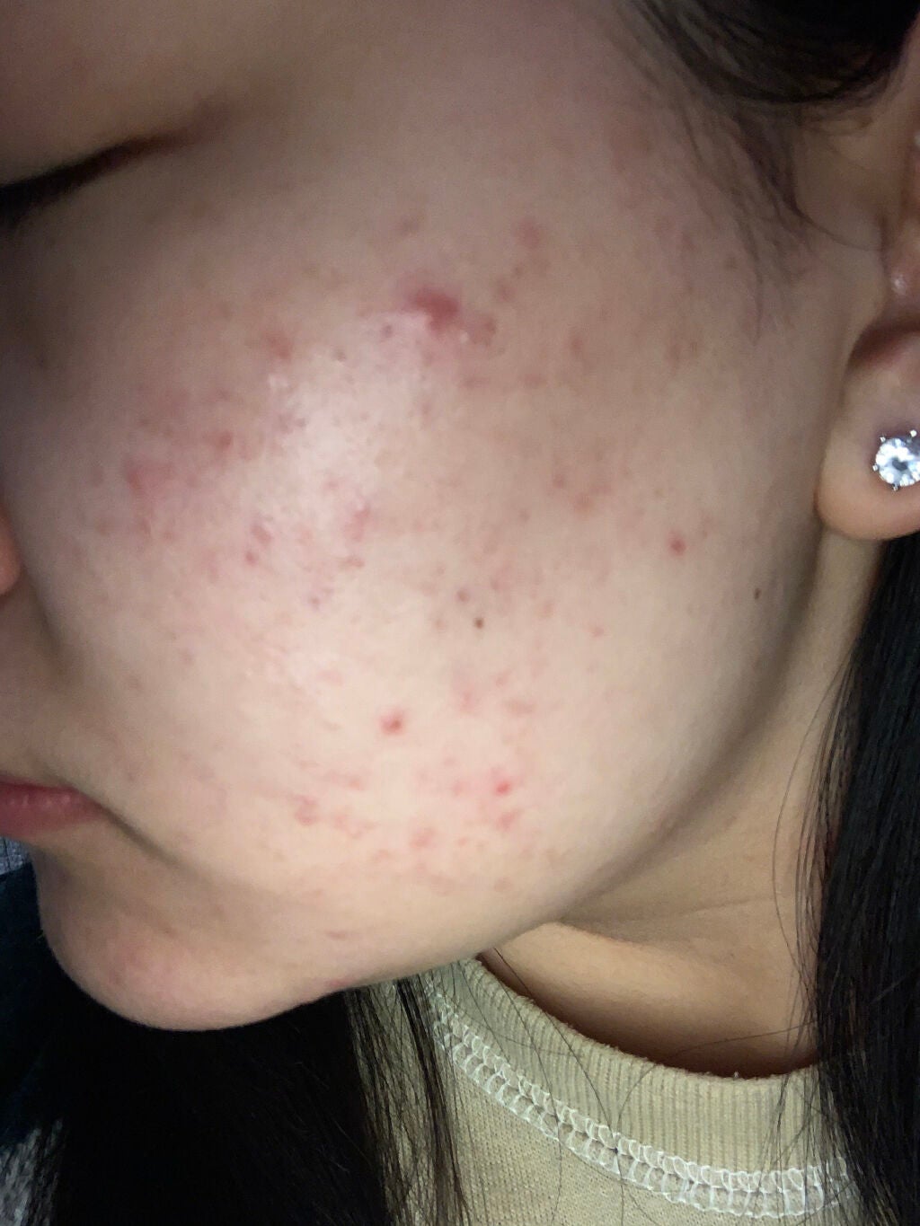 ティーツリーケア ソリューション エッセンシャルマスクEX/MEDIHEAL/シートマスク・パックを使ったクチコミ(2枚目)