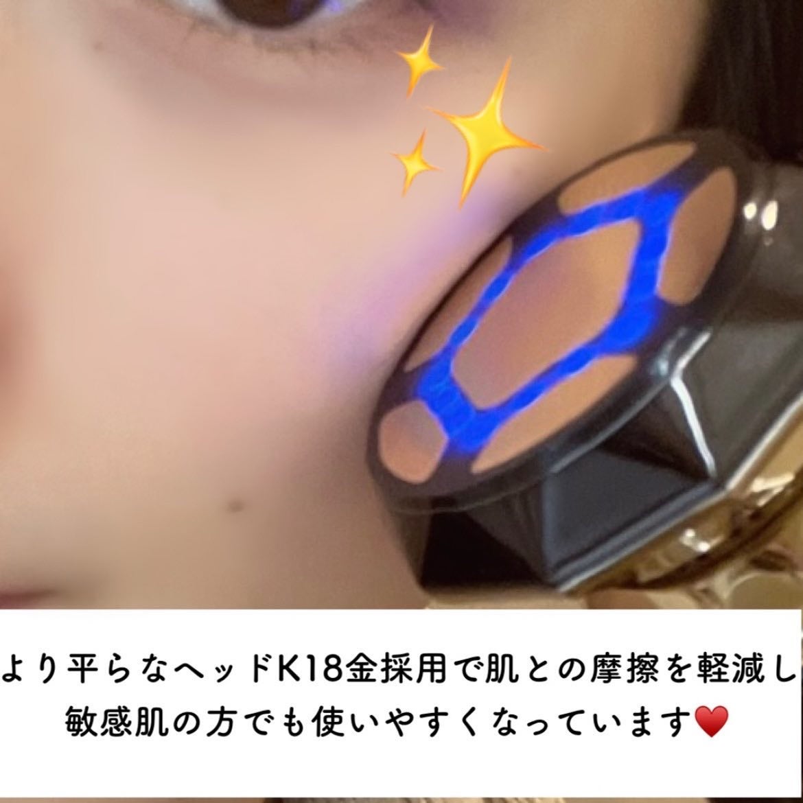RF温冷美顔器PRO/ANLAN/美顔器・マッサージを使ったクチコミ(5枚目)