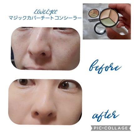 lovelycc マジックカバーチートコンシーラー/LOVELYCC/パレットコンシーラーを使ったクチコミ(3枚目)