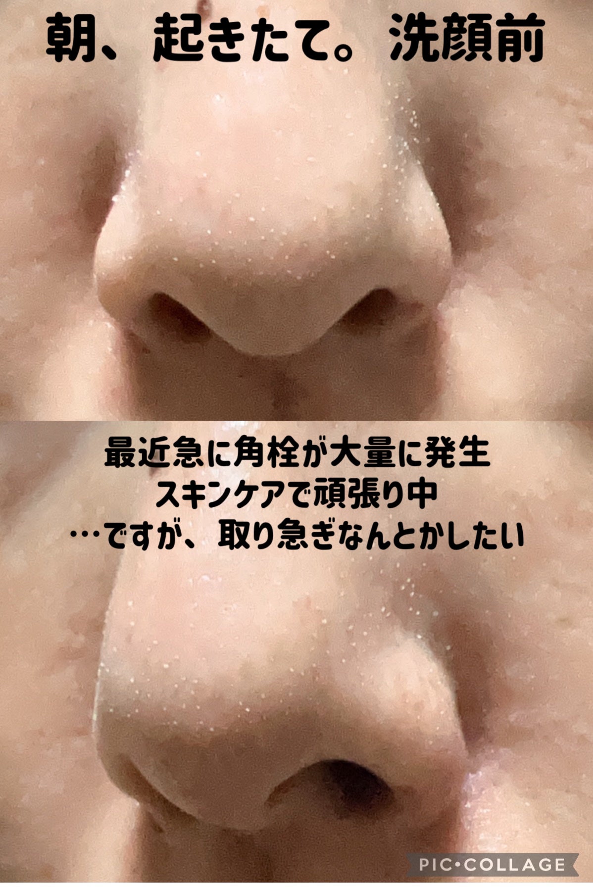 ソフィーナ iP ポア クリアリング ジェル ウォッシュ/SOFINA iP/その他洗顔料を使ったクチコミ(3枚目)