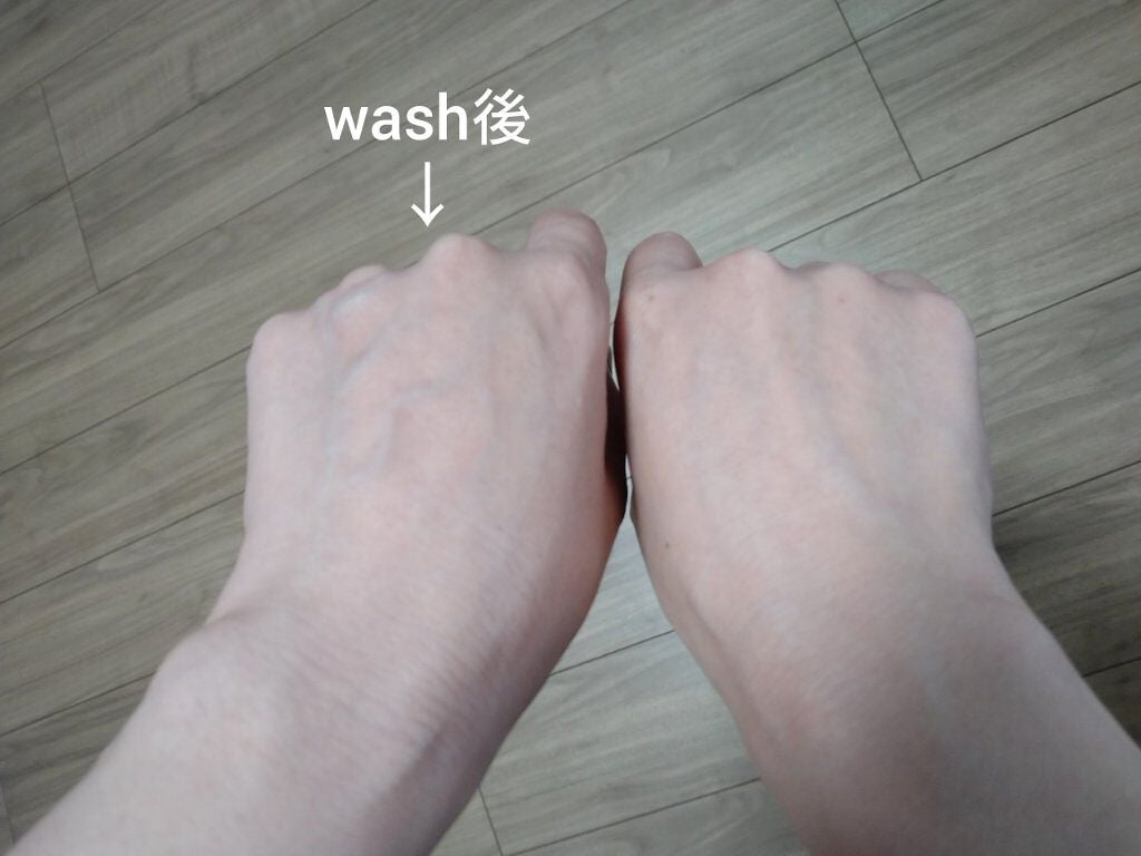 パーフェクトホイップ アクネケア/SENKA(専科)/洗顔フォームを使ったクチコミ(5枚目)