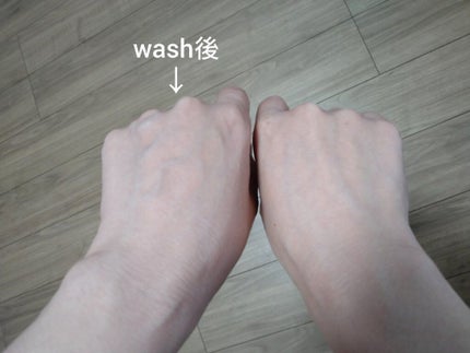 パーフェクトホイップ アクネケア/SENKA(専科)/洗顔フォームを使ったクチコミ(5枚目)