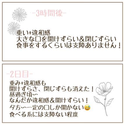 sayu on LIPS 「ずっとずっとやりたかったエラボトックス受けて来ました💓今回私は..」(5枚目)