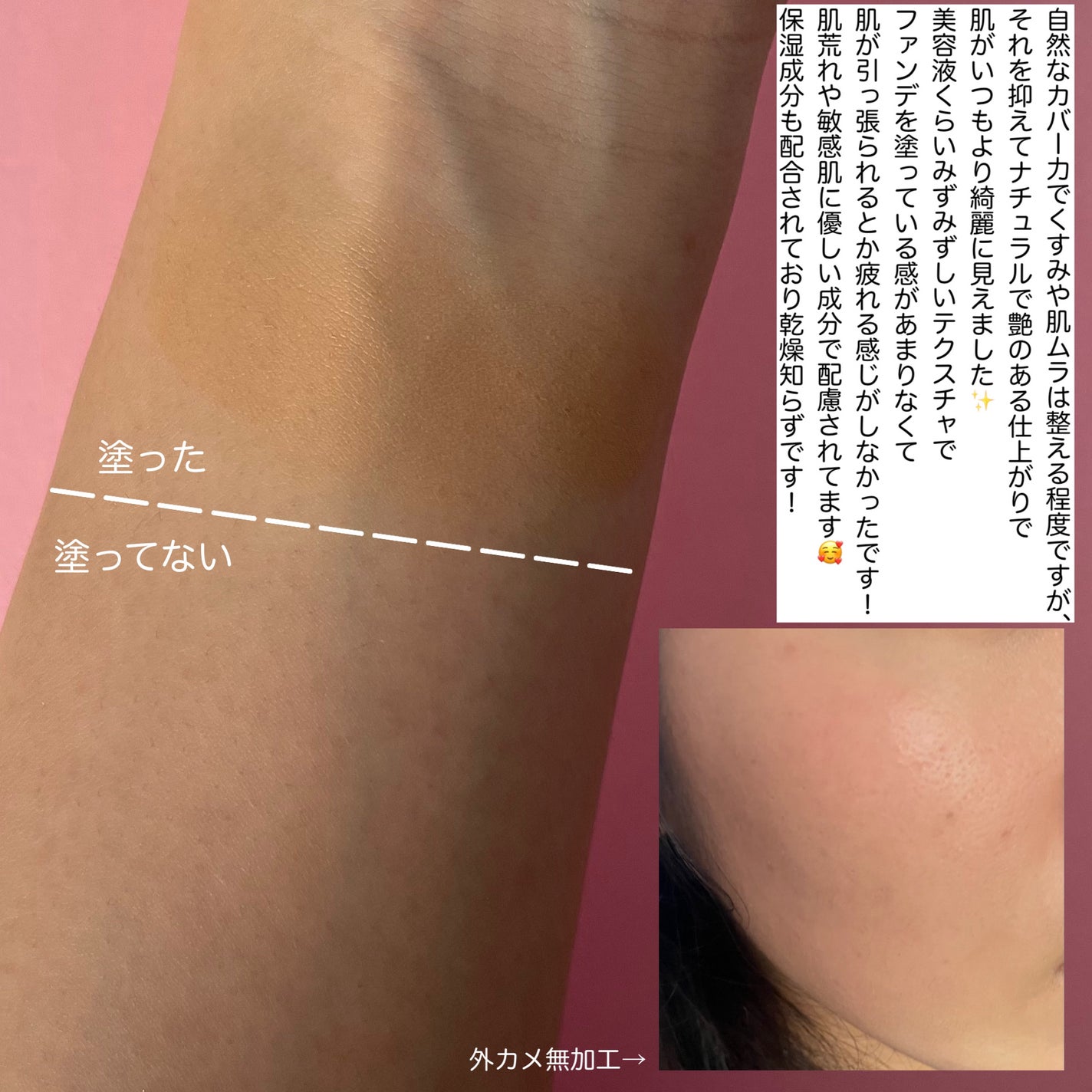 デューイーメッシュファンデーション/ASUNE /クッションファンデーションを使ったクチコミ(6枚目)