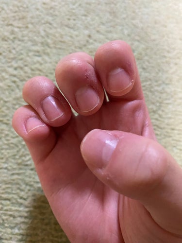 キューティクルネイルオイル ペンタイプ/No nail No life/ネイル用品を使ったクチコミ（4枚目）