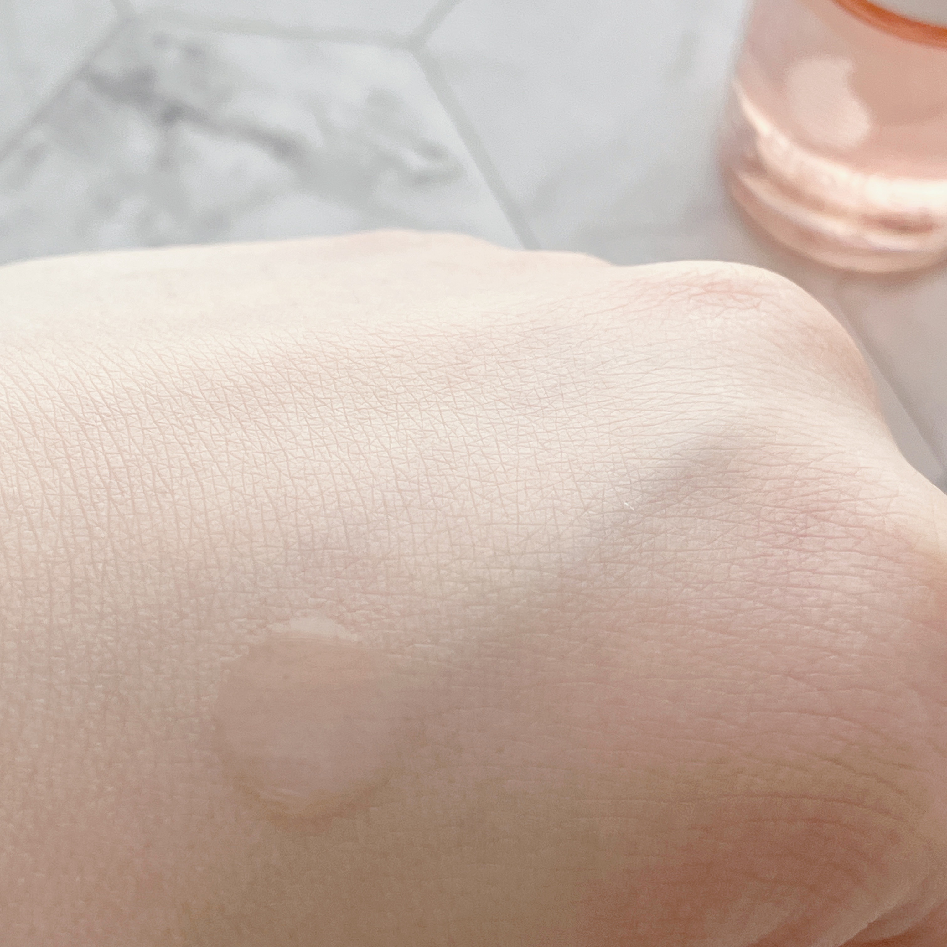 バイオイル/バイオイル/フェイスオイルを使ったクチコミ（2枚目）