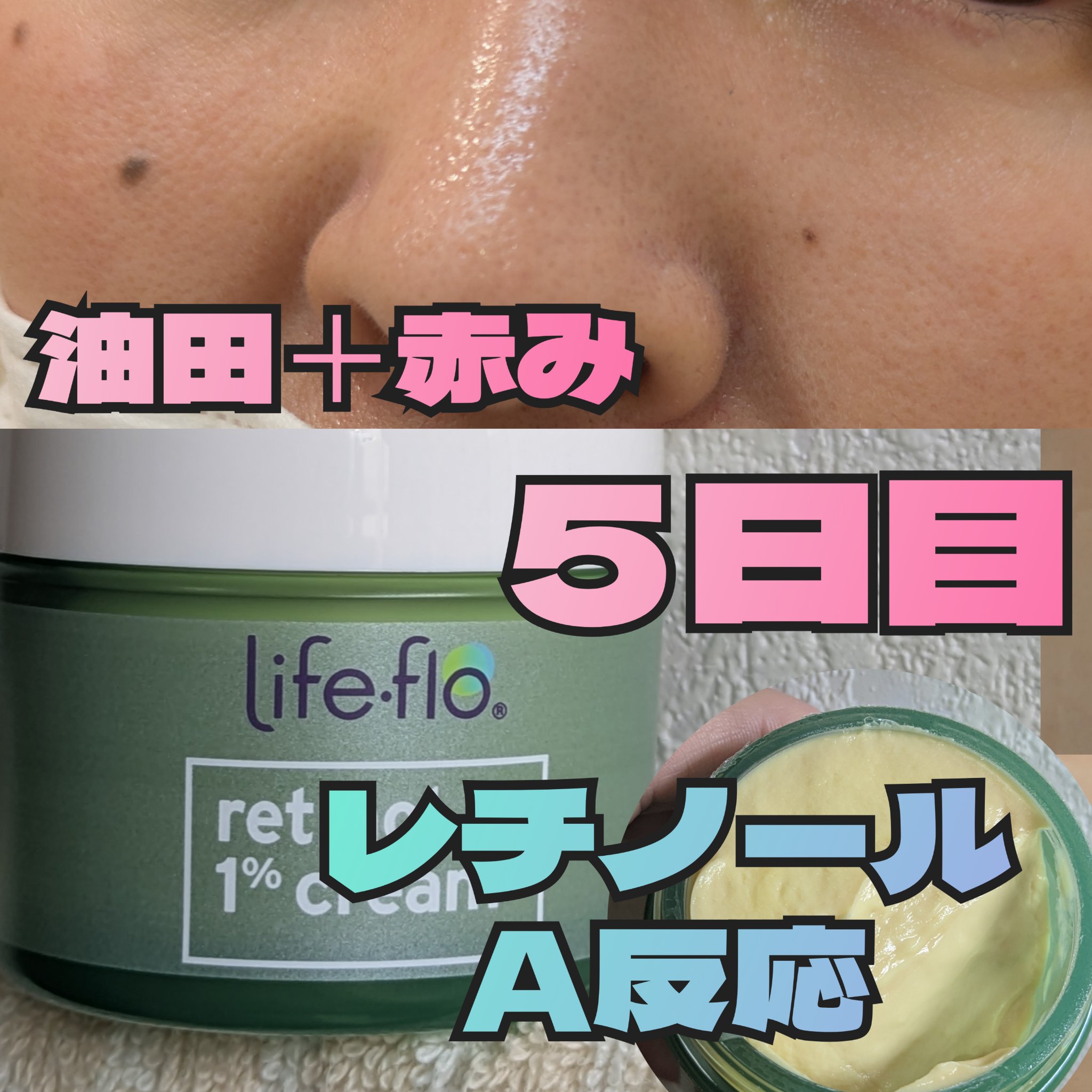 レチノールA 1% アドバンスドリバイタリゼーションクリーム/Life-flo/フェイスクリームを使ったクチコミ（1枚目）