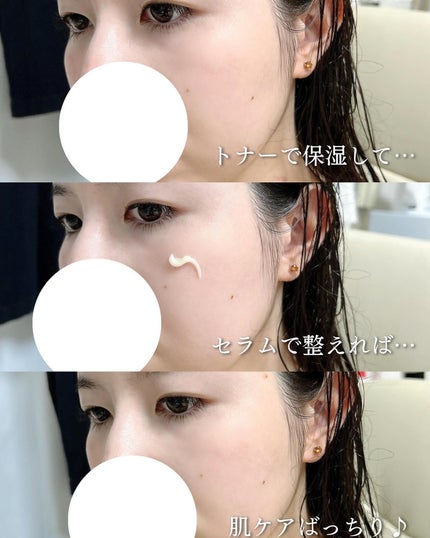 ヴィーガンリポソームレチノールセラム/SKIN&LAB/美容液を使ったクチコミ(4枚目)