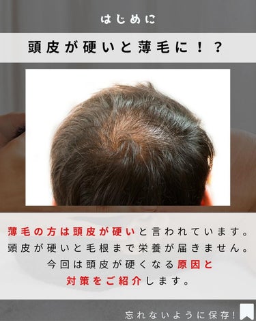 uka uka scalp brush kenzanのクチコミ「今回は若見えには必須な薄毛対策についてご紹介します。
薄毛になっている頭皮は、共通してがちがち.....」（2枚目）