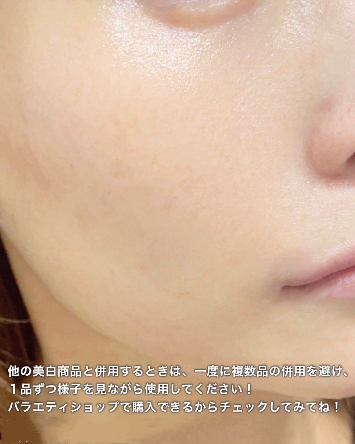 ダーマエイド トリプルアクティブローション【医薬部外品】/pdc/化粧水を使ったクチコミ(6枚目)