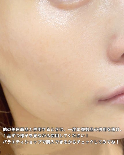 ダーマエイド トリプルアクティブローション【医薬部外品】/pdc/化粧水を使ったクチコミ(6枚目)