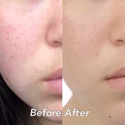 乳液・敏感肌用・さっぱりタイプ/無印良品/乳液を使ったクチコミ(4枚目)