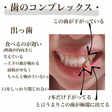 ゆいちゃんまん ᵕ̈* on LIPS 「🦷矯正記録1🦷こんにちは〜⸜🌷︎⸝‍ゆいちゃんまんです🦋今回の..」（3枚目）