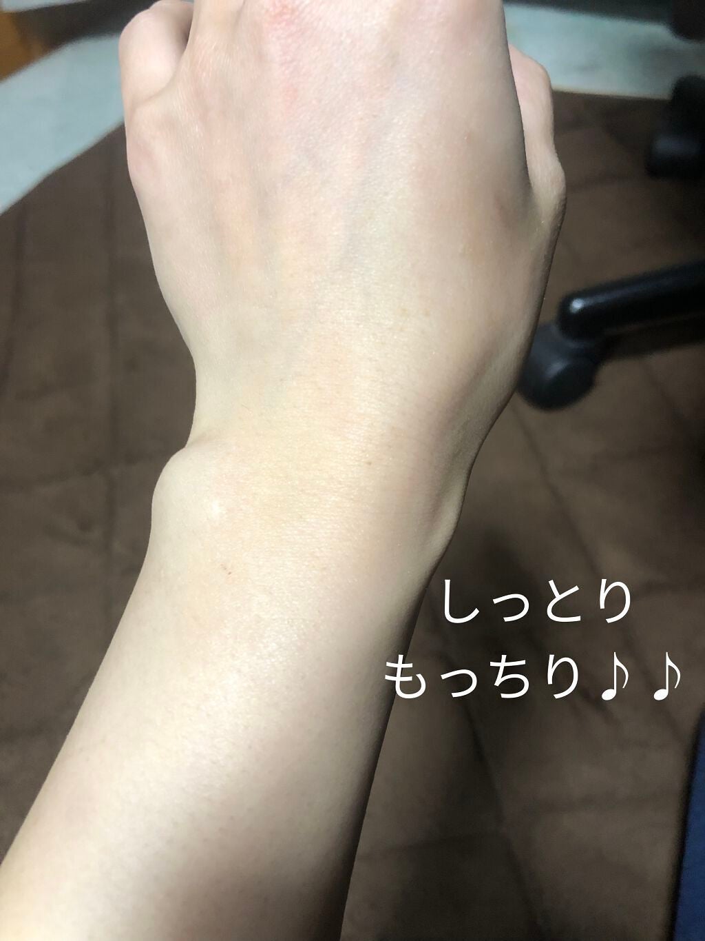 ミノン全身保湿クリーム/ミノン/ボディクリームを使ったクチコミ(6枚目)