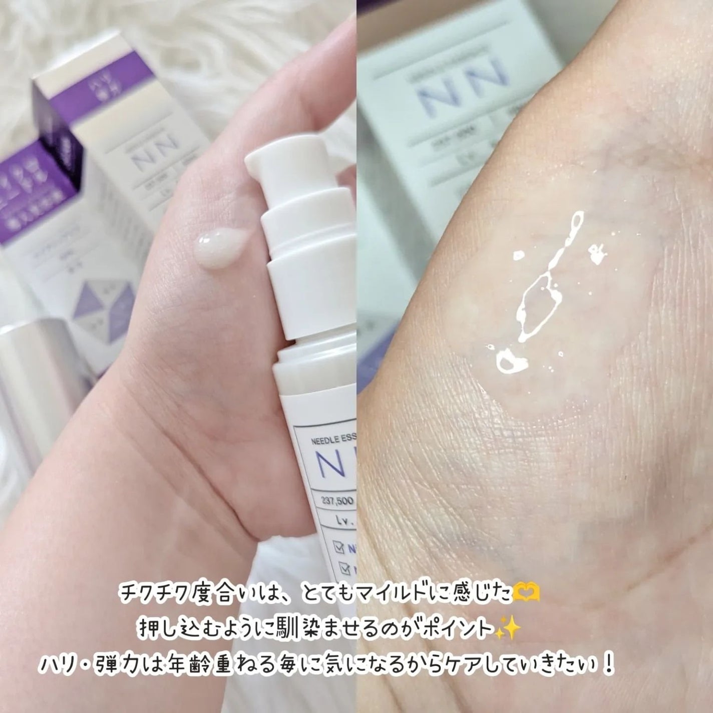 ビディ ニードルエッセンス NN/ビディ/美容液を使ったクチコミ(3枚目)